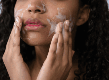Woman with mild acne washes face with foaming face wash