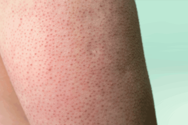 Red bumps on the back of arm